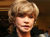 Вера Алентова после неудачного хирургического омоложения лица. © Фото StarAndStar